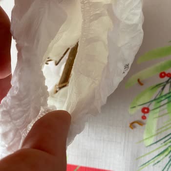 Sleepy Bebek Bezinde Yabancı Madde Ve Toz Sorunu