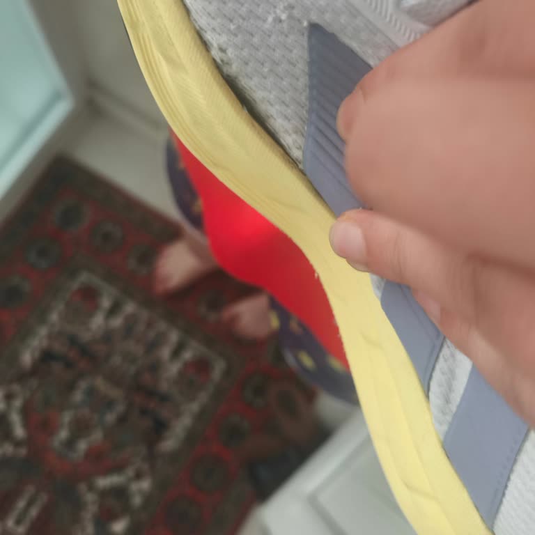 Adidas Galaxy 7 Ayakkabım 1 Ayda Yırtıldı, Hayal Kırıklığı Yaşadım