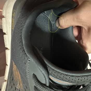 Kısa Sürede Hasar Gören Skechers Ayakkabı Ve Yetersiz Ürün Kalitesi