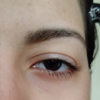 Cream Co. Tester Nemlendirici Göz Altımda Alerjik Reaksiyona Sebep Oldu!