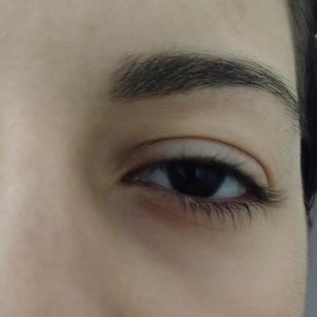 Cream Co. Tester Nemlendirici Göz Altımda Alerjik Reaksiyona Sebep Oldu!