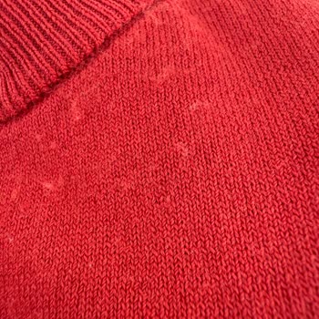 Beymen Club'tan Aldığım Üründe Tüylenme Ve İletişim Sorunu