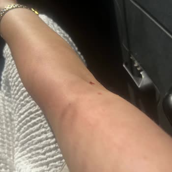 Sağlık Bakanlığı Hastanede Yanlış Bilgi Ve Güvenlik Görevlilerinin Saldırgan Davranışı