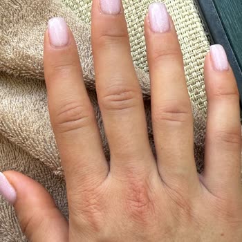 Otelde Yaşanan Kaza Sonrası Yetersiz Kriz Yönetimi Ve İlgisiz Yaklaşım