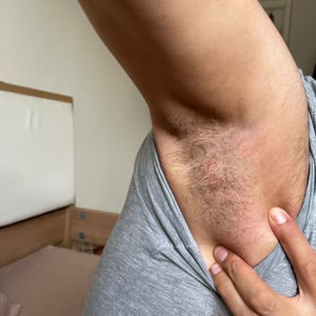 Koltuk Altında Ağrılı Şişlik Ve Cilt Sorunu Yaşadım