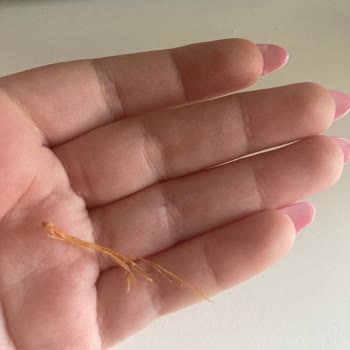 Cipsin İçinden Yabancı Madde Çıkması Nedeniyle Güven Kaybı