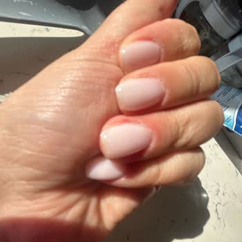 Kalitesiz Manikür Sonrası Ağrı Ve Mağduriyet: Ücret İadesi Ve Açıklama Talebi