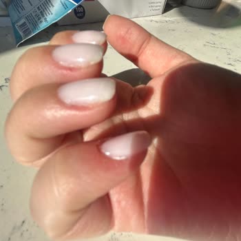 Kalitesiz Manikür Sonrası Ağrı Ve Mağduriyet: Ücret İadesi Ve Açıklama Talebi