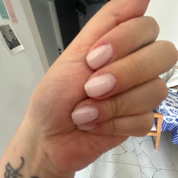 Kalitesiz Manikür Sonrası Ağrı Ve Mağduriyet: Ücret İadesi Ve Açıklama Talebi