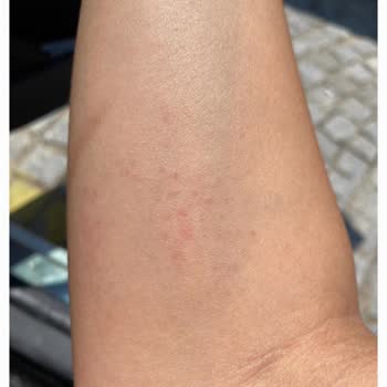 Alerji Yapan Parfüm İçin İade Süreci Mağduriyeti Ve Bilgilendirme Eksikliği