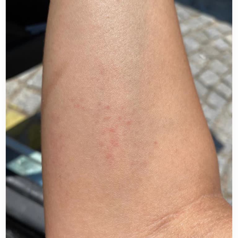 Alerji Yapan Parfüm İçin İade Süreci Mağduriyeti Ve Bilgilendirme Eksikliği