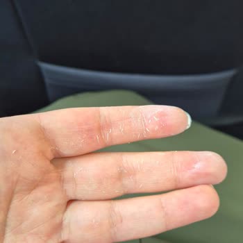 Sahte Ürün Ve Yetersiz Müşteri Desteği