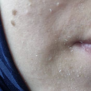 Sahte Ürün Ve Yetersiz Müşteri Desteği