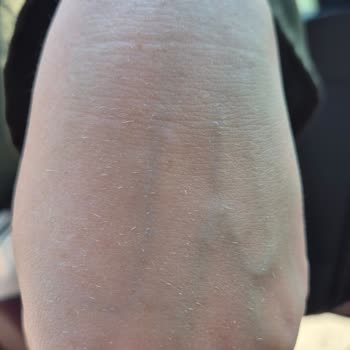 Sahte Ürün Ve Yetersiz Müşteri Desteği