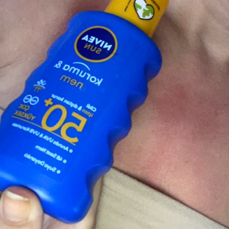 Nivea Sun Güneş Kremi Cildimde Ciddi Yanıklara Sebep Oldu
