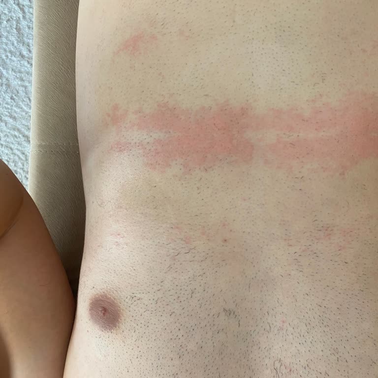 Tüy Dökücü Ürün Cildimde Ciddi Tahrişe Neden Oldu