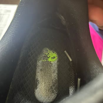 Lescon Ayakkabıda Kısa Sürede Yırtılma Ve Kullanıcı Hatası Gerekçesiyle Ret