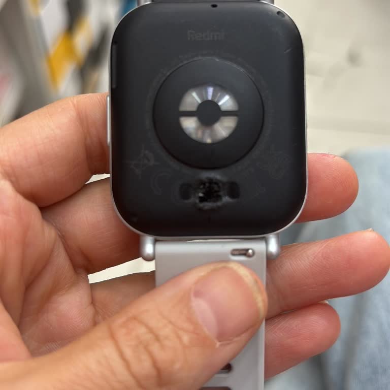 Redmi Watch 5 Active Şarj Cihazı Yanması Ve Müşteri Hizmetlerine Ulaşılamaması
