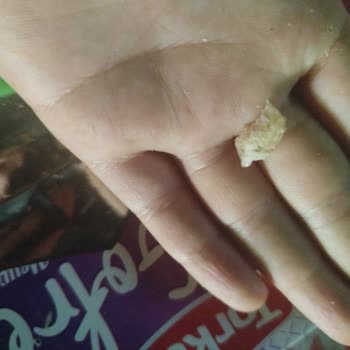 Torku Meyveli Gofret Dişimi Kırdı!