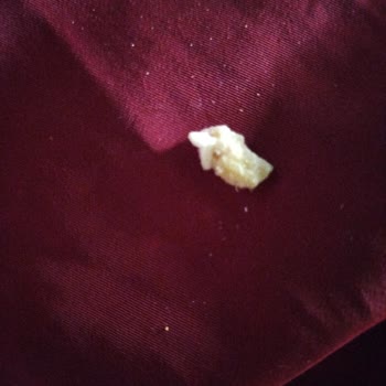 Torku Meyveli Gofret Dişimi Kırdı!