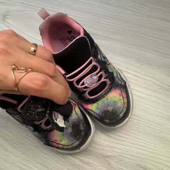 Skechers Ayakkabıda Erken Deformasyon Ve Yetersiz Müşteri Desteği!