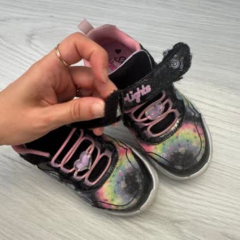 Skechers Ayakkabıda Erken Deformasyon Ve Yetersiz Müşteri Desteği!