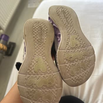 Skechers Ayakkabıda Erken Deformasyon Ve Yetersiz Müşteri Desteği!