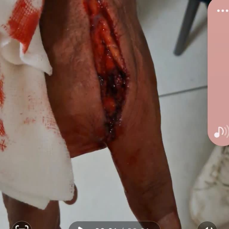 Acil Müdahalede Gecikme Ve Sert Üslup Mağduriyeti