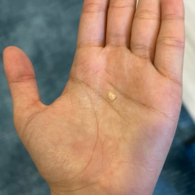 Vivident Sakızdan Yabancı Madde Çıkması Şaşırttı