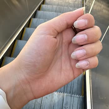 Hijyenik Olmayan Ortam Ve Saygısız Hizmet Nedeniyle Memnuniyetsizlik