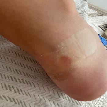 FLO Ayakkabı Her Giydiğimde Ayağımı Vurdu