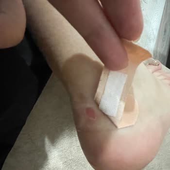 FLO Ayakkabı Her Giydiğimde Ayağımı Vurdu