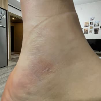 FLO Ayakkabı Her Giydiğimde Ayağımı Vurdu