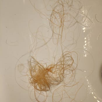 Saç Kaynak Merkezinde Renk Ve Kalite Fiyaskosu: Hem Saçımdan Hem Paramdan Oldum