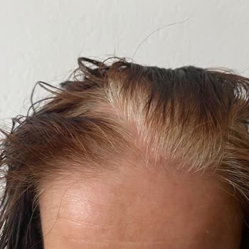 L'oreal Exellence Saç Boyası Beyazları Kapatmıyor