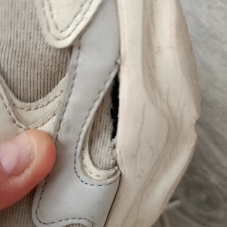 Yüksek Fiyatlı Skechers Ayakkabının Kısa Sürede Yırtılması Ve İlgisiz Müşteri Hizmeti