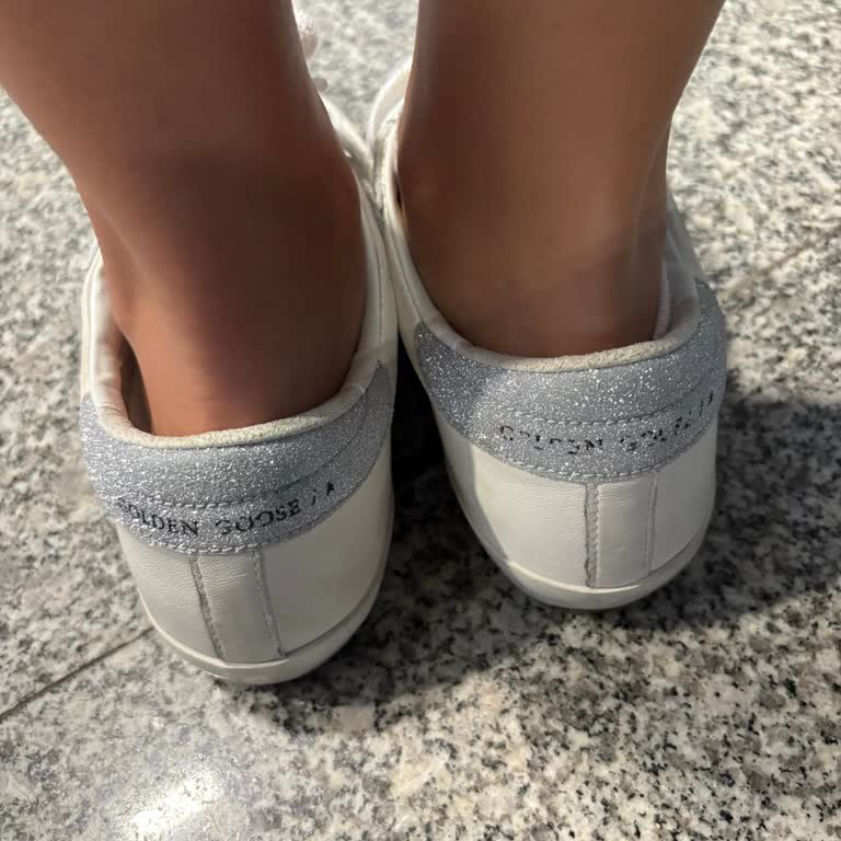 Dünya Markası Ayakkabıda Yazı Silinmesi Ve İlgisiz Müşteri Hizmeti