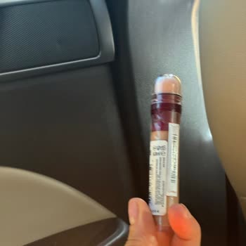 Watsons Mağazasında Kısa Sürede İade Reddi Şaşkınlığı