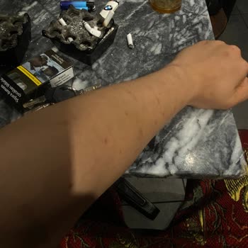 Duman Beauty Yanıltıcı Fiyatlandırma ve Sağlık Sorunlarıyla Sonuçlanan Acı Verici Lazer Deneyimi