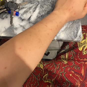 Duman Beauty Yanıltıcı Fiyatlandırma ve Sağlık Sorunlarıyla Sonuçlanan Acı Verici Lazer Deneyimi