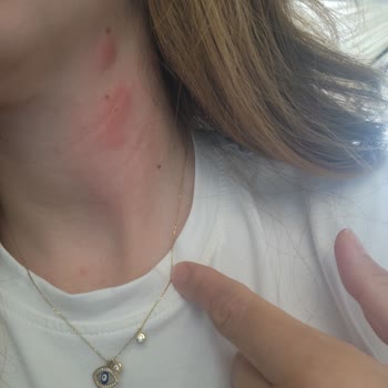 Prontotour İtalya Turu: Kötü Otel Ve Yetersiz Rehberlik Deneyimi