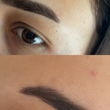 Instagramda Gördüğüm Kaş İşlemi Hayal Kırıklığı Yaşattı