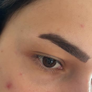 Instagramda Gördüğüm Kaş İşlemi Hayal Kırıklığı Yaşattı