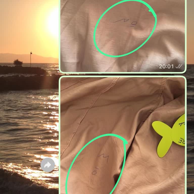 Yanlış Kumaş Ve Lekeli Ceket Mağduriyeti