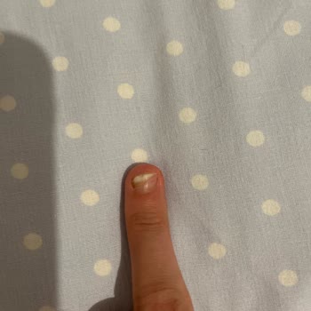 Hijyen Eksikliği Nedeniyle Sağlık Sorunları Ve İlgisizlik