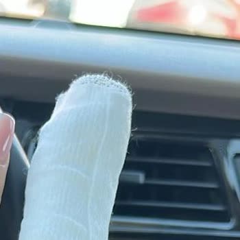 Hijyen Eksikliği Nedeniyle Sağlık Sorunları Ve İlgisizlik