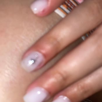 Manikür Sonrası Tırnak Etlerimde Sürekli Kanama Ve İltihap