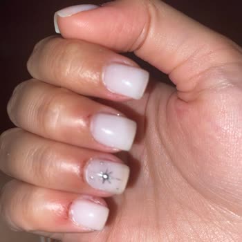 Manikür Sonrası Tırnak Etlerimde Sürekli Kanama Ve İltihap