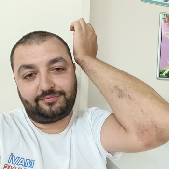 Ön Koruma Demiri Arızası Nedeniyle Yaşanan Güvenlik Sorunu