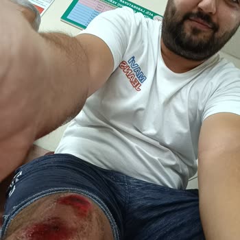 Ön Koruma Demiri Arızası Nedeniyle Yaşanan Güvenlik Sorunu